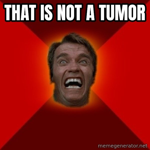 Angry Arnold meme: that is not  a tumor