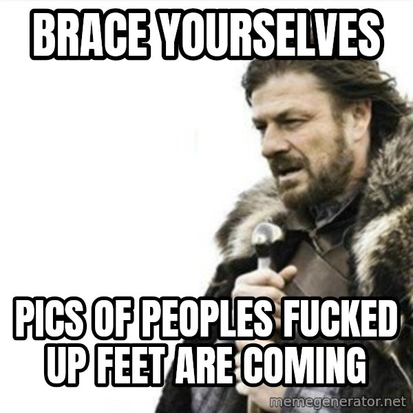 Prepare yourself meme: Brace Yourselves / Pics of peoples fucked up feet are coming