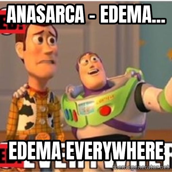 X, X Everywhere  meme: Anasarca - Edema... / edema everywhere