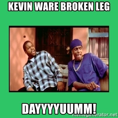 Friday Damn - Kevin ware broken leg dayyyyuumm!