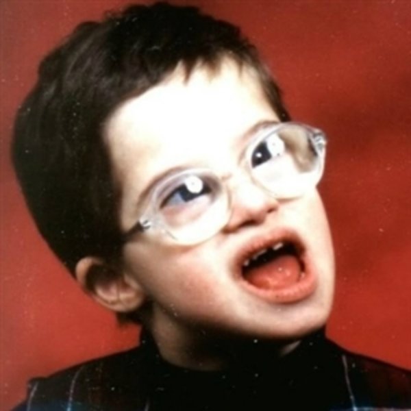 retarded kid with glasses meme template